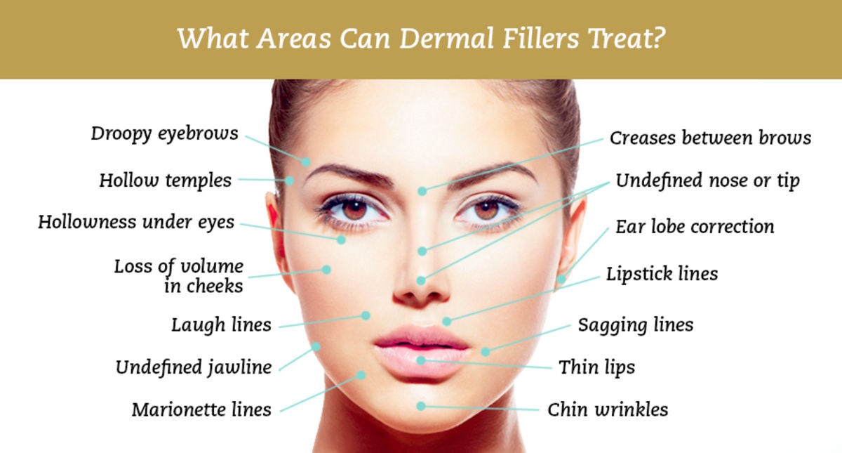 dermal-filler-Sydney-CBD-Beauty